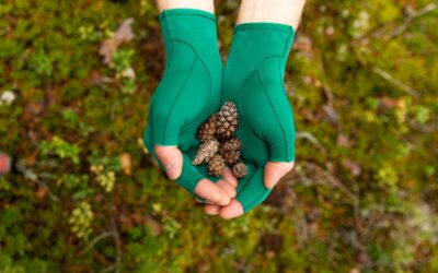 Gloves Põletusarmide raviks kindad